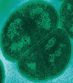 Deinococcus radiolarians